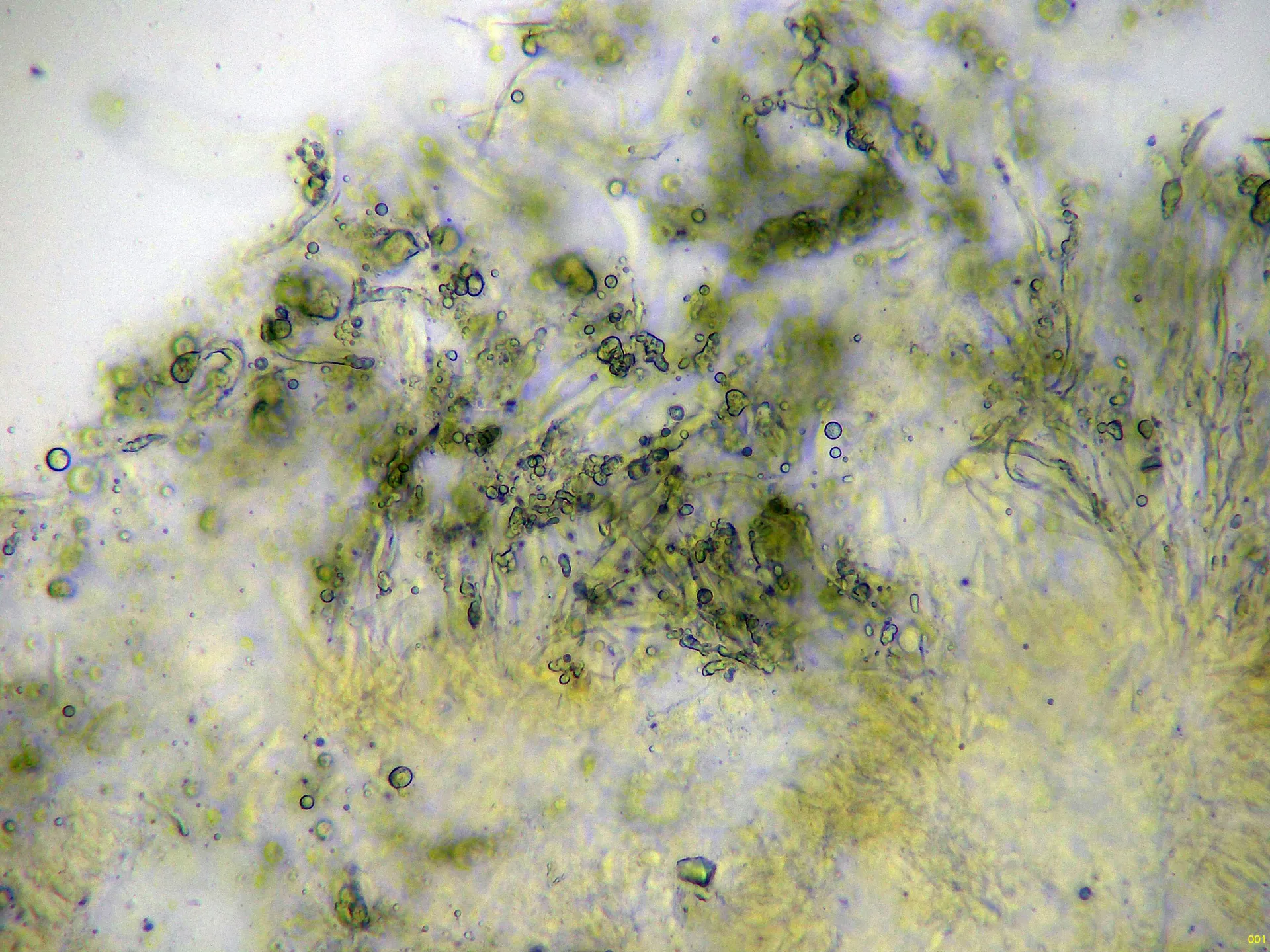 Microscopía de Panellus stipticus - 10 - Arista amoníaco x 400-001